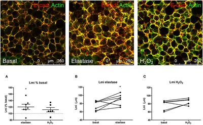 Elastase-Induced Parenchymal Disruption and Airway Hyper Responsiveness in Mouse Precision Cut Lung Slices: Toward an Ex vivo COPD Model